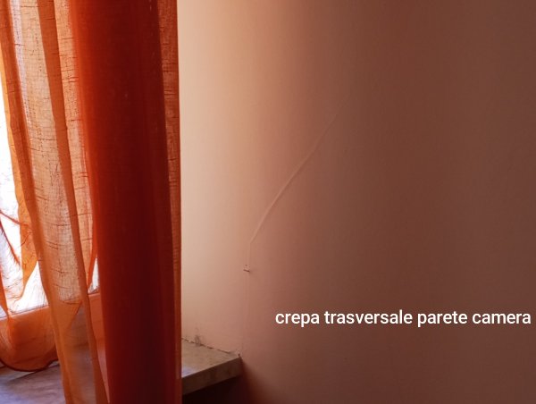 Frattura trasversale su parete interna: quali sono...